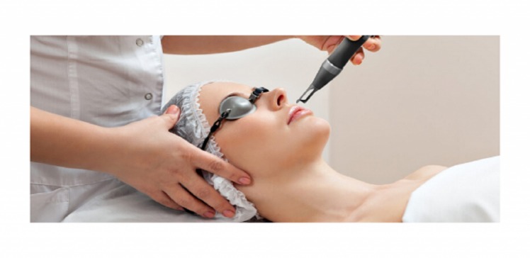 How to Take Care of Face After Laser Treatment