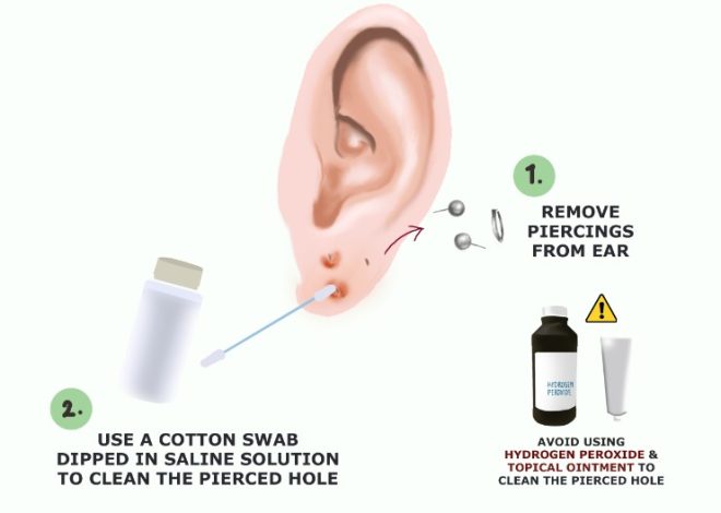 Earwax Elimination: Just How To Safely Eliminate It In The House